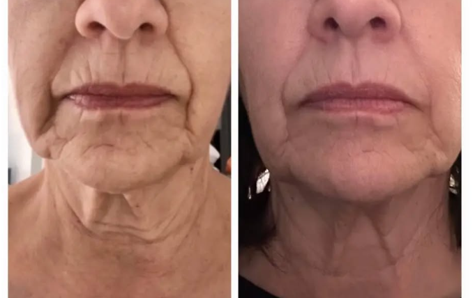 results after one meeting